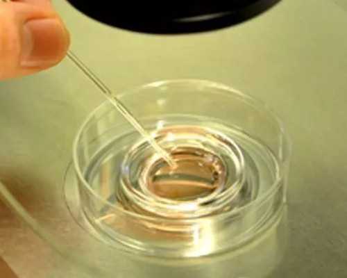 山东试管婴儿供卵,天津试管助孕价格-正规试管中介